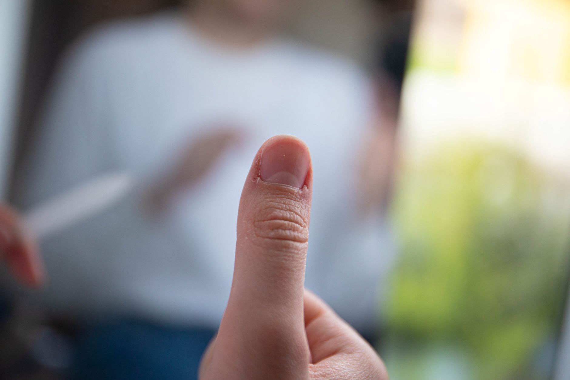 Ca người lớn tuổi có rãnh vân tay nông